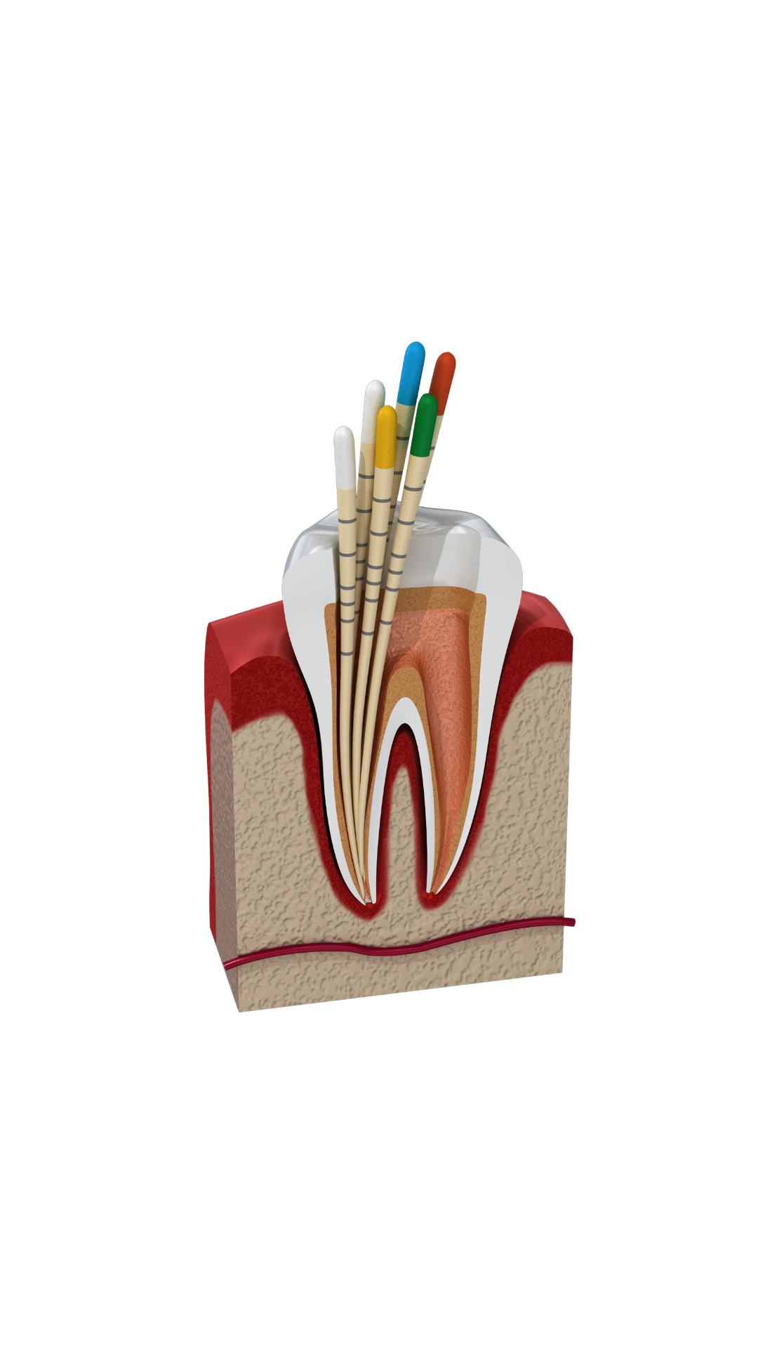 Endodontics