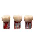 Endo Acrylic Teeth